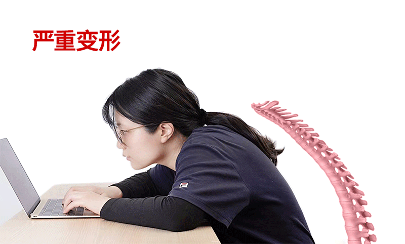 有了这个“外骨骼”体态好了脖子不痛了还能随时随地做颈椎艾灸亿博电竞 亿博官网(图12)
