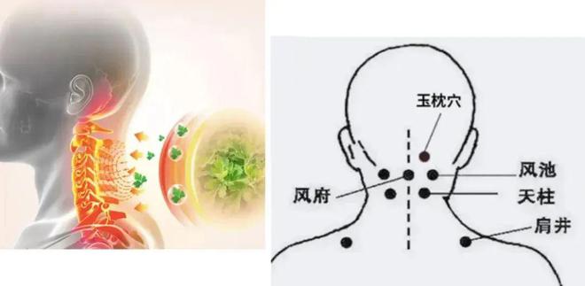 有了这个“外骨骼”体态好了脖子不痛了还能随时随地做颈椎艾灸亿博电竞 亿博官网(图19)